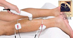 Terapia de electroestimulacion y ultrasonido  ya sea combinados  o por separado,aplicacion de lacer terapeutico, son efectivas en recuperación muscular, lesiones por esfuerzo físico normal o deportivo